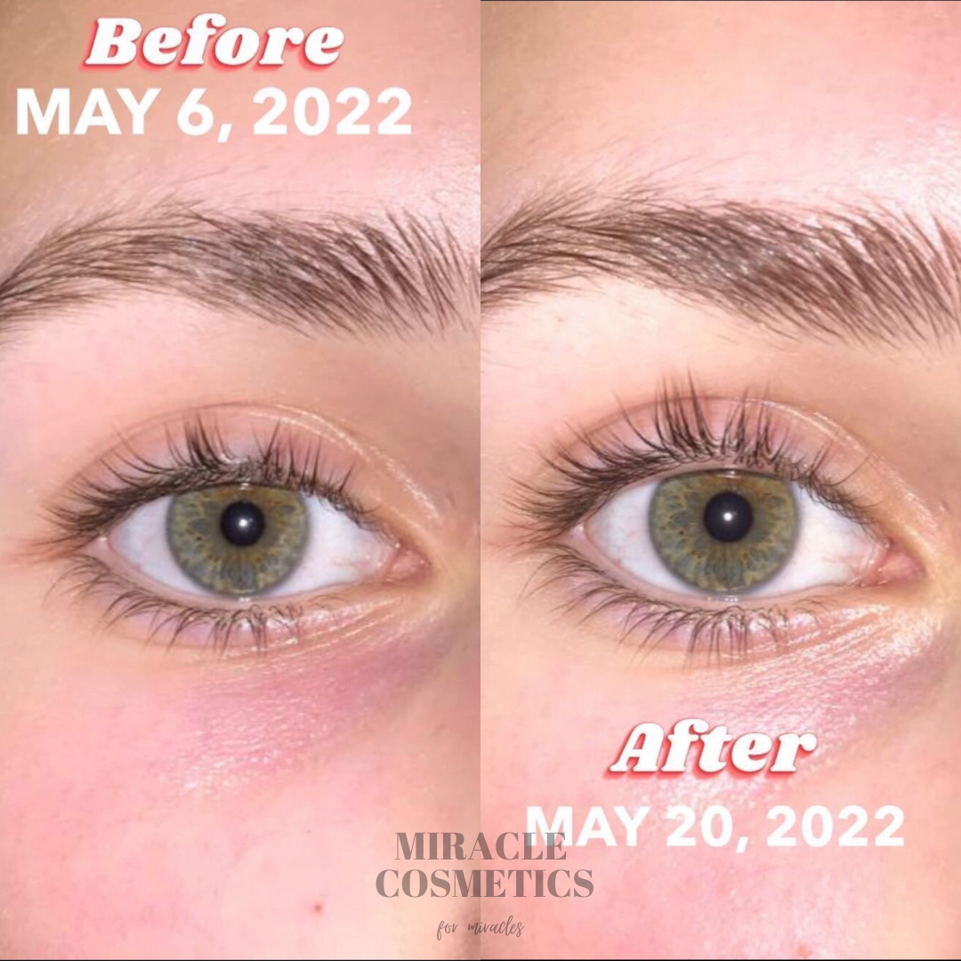 Eyelash Growth Serum