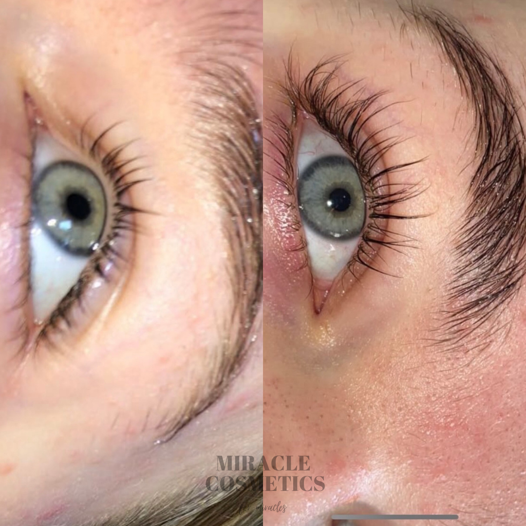 Eyelash Growth Serum