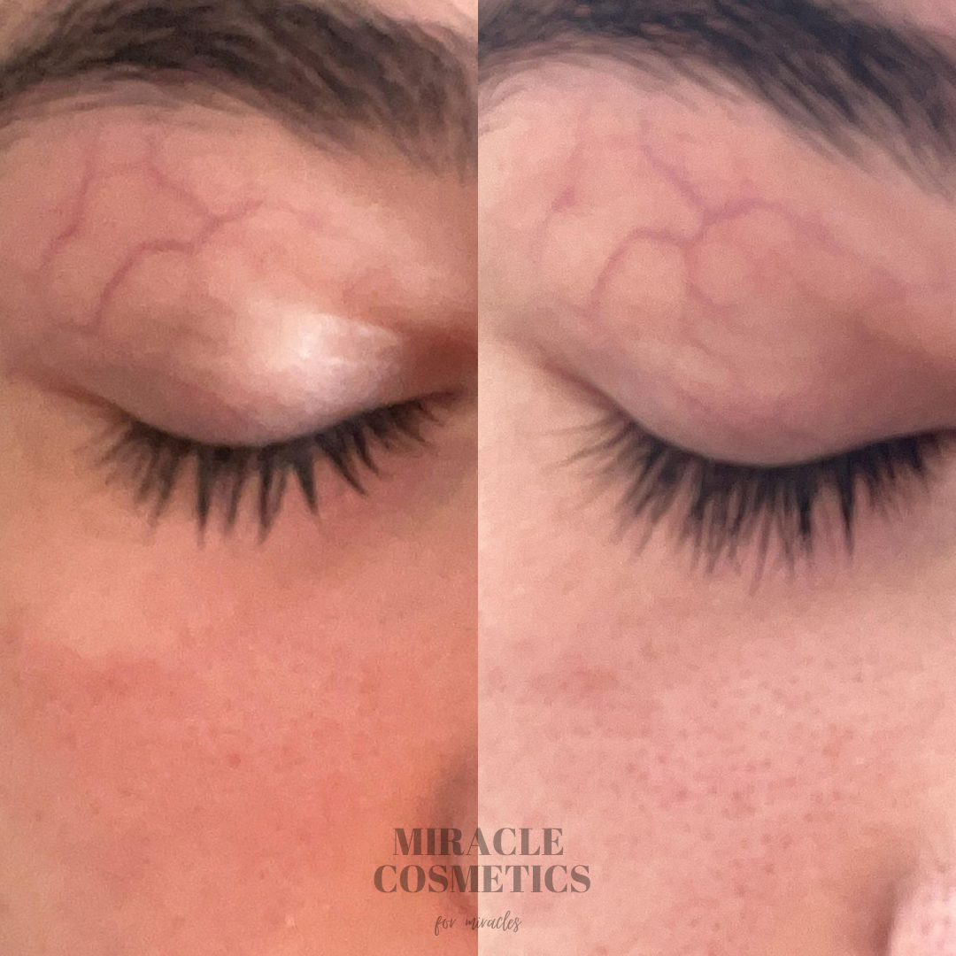 Eyelash Growth Serum