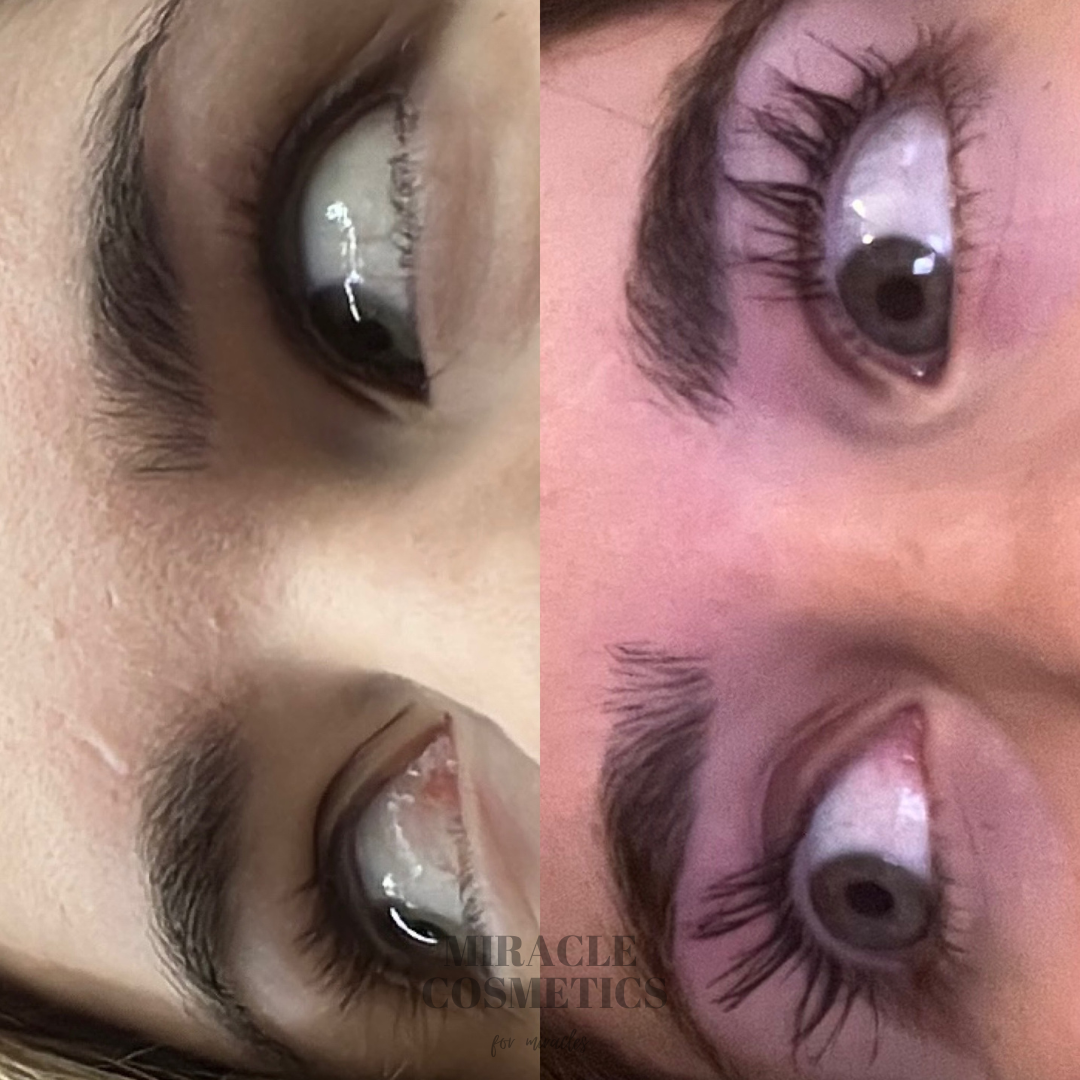Eyelash Growth Serum