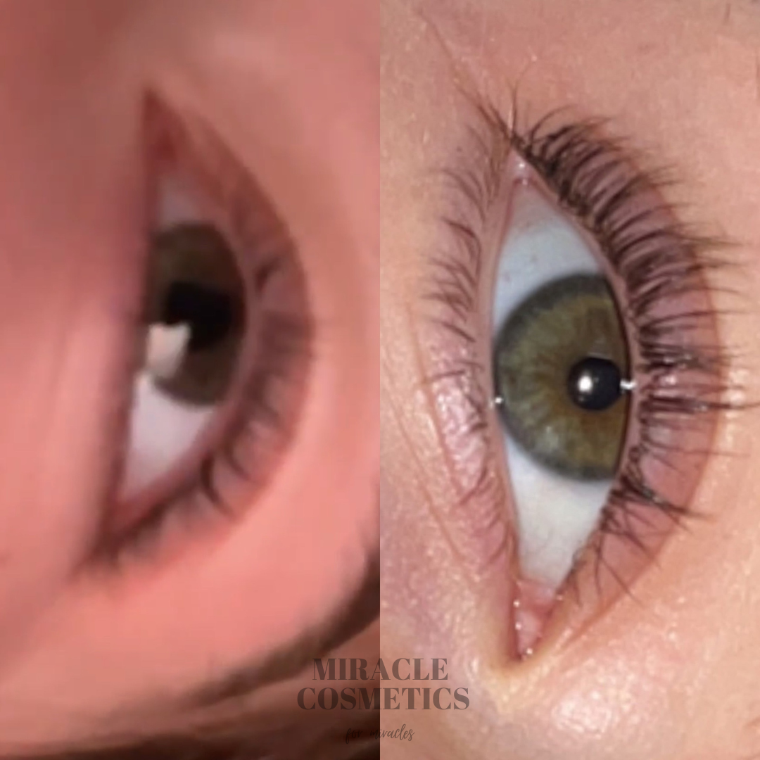 Eyelash Growth Serum